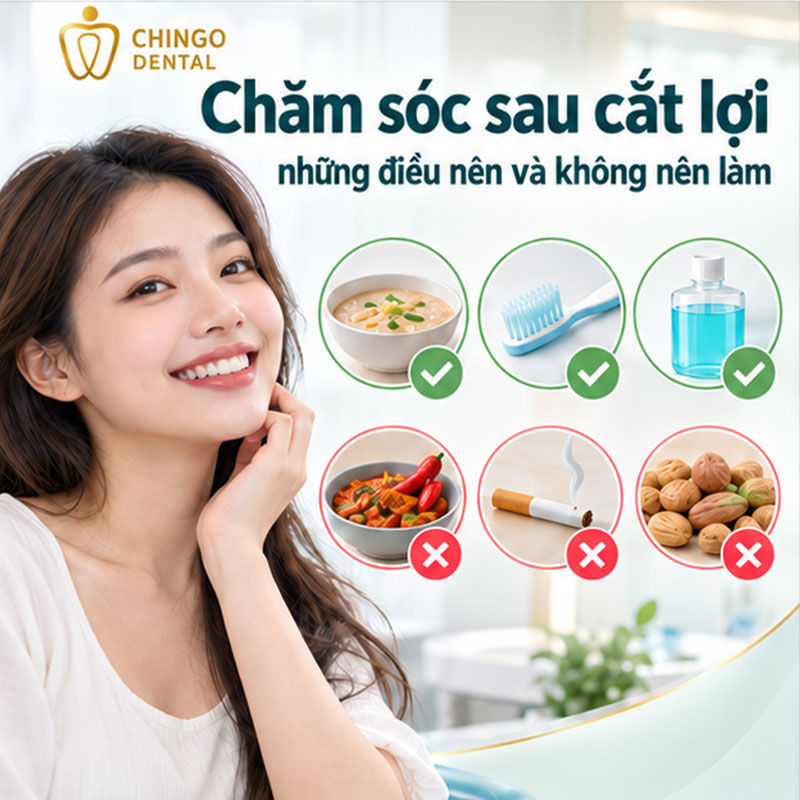 Cắt Lợi Có Đau Không? Giải Đáp Từ A - Z Cho Người Lần Đầu Thực Hiện 4 chi phí cắt lợi