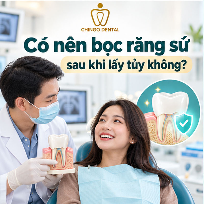 Bọc Răng Sứ Có Lấy Tủy Không? Giải Đáp Chi Tiết - Chingo Dental 3 có nên bọc răng sứ sau khi lấy tủy