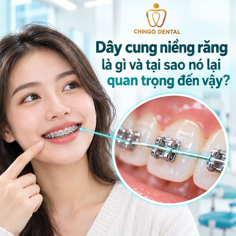 Đứt Dây Cung Niềng Răng: Nguyên Nhân, Cách Xử Lý Tạm Thời & Khi Nào Cần Gặp Bác Sĩ Ngay 1 dây cung niềng răng