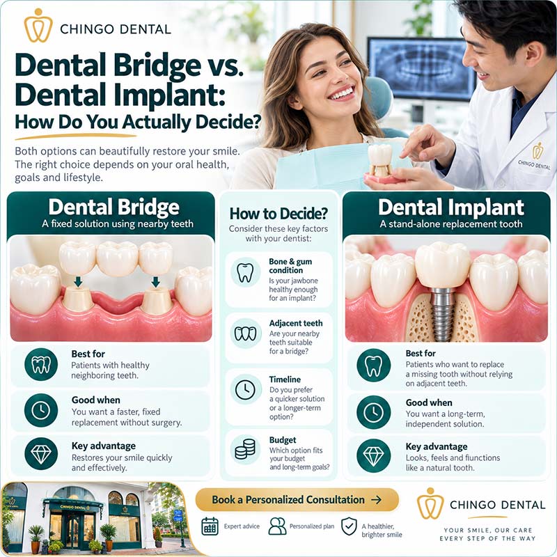 Dental Bridge: Your Complete Guide to Replacing Missing Teeth 5 dental bridge procedure