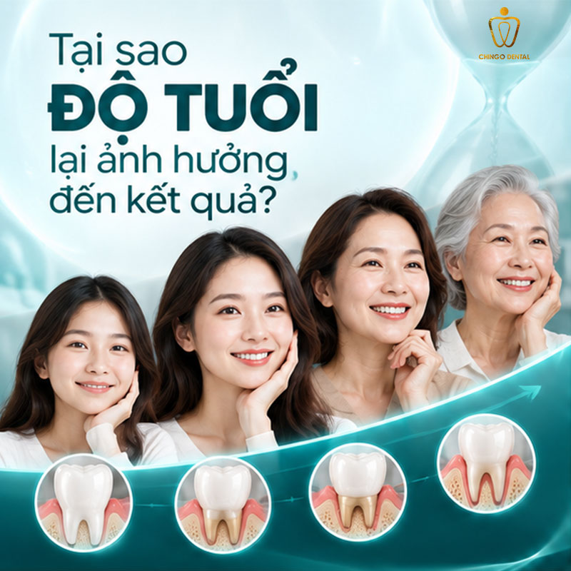 Độ Tuổi Bọc Răng Sứ: Bao Nhiêu Tuổi Là Phù Hợp Và Những Điều Cần Biết 1 độ tuổi bọc răng sứ