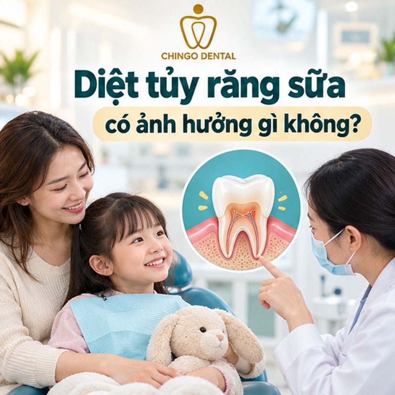 Bọc Răng Sứ Có Lấy Tủy Không? Giải Đáp Chi Tiết - Chingo Dental 4 giá bọc răng sứ sau khi lấy tủy