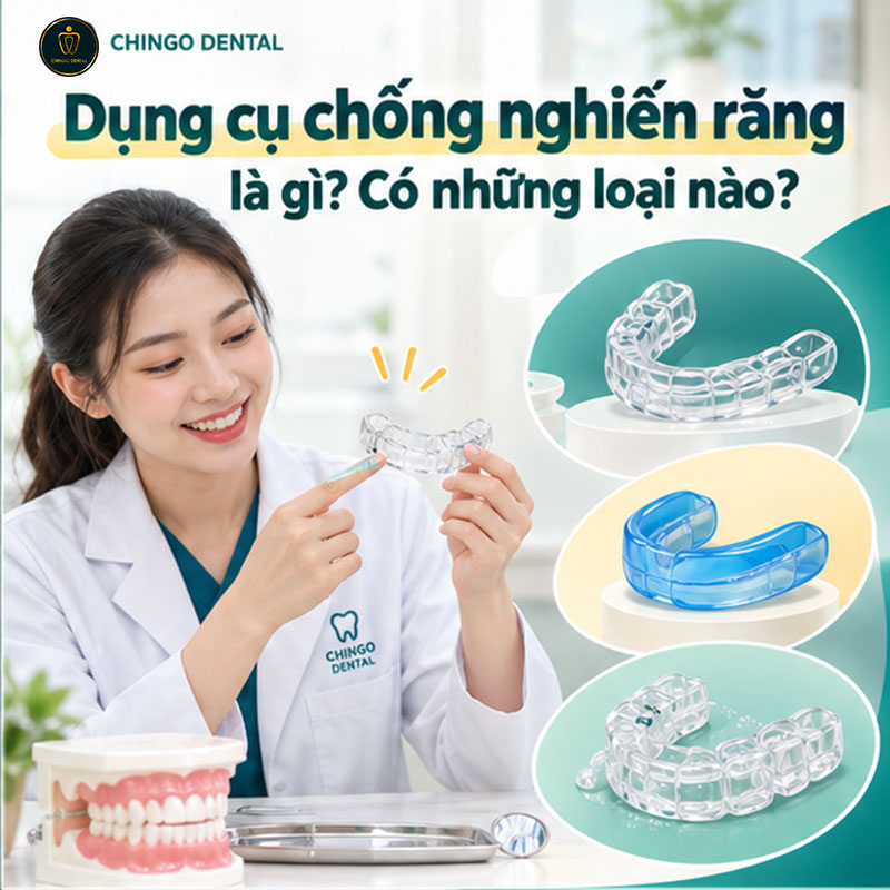 Dụng Cụ Chống Nghiến Răng: Phân Loại, Hiệu Quả và Hướng Dẫn Lựa Chọn Đúng 2 giá máng chống nghiến răng