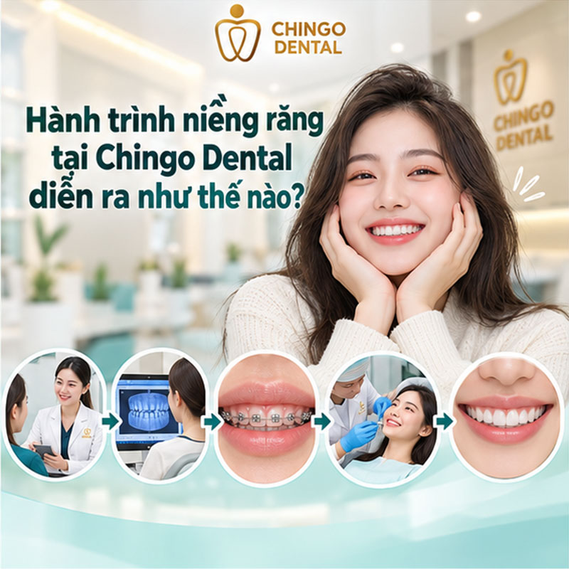 Quá Trình Thay Đổi Khi Niềng Răng: Hành Trình Từ Trước Và Sau Mà Bạn Cần Biết 9 góc nghiêng trước và sau khi niềng răng