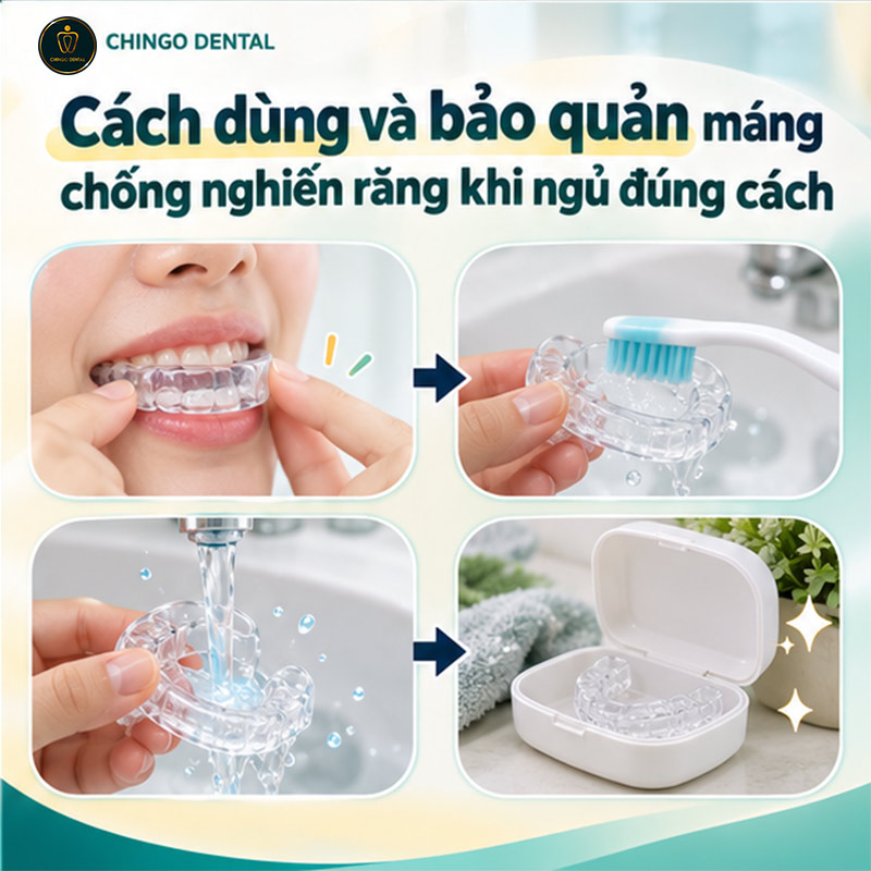 Dụng Cụ Chống Nghiến Răng: Phân Loại, Hiệu Quả và Hướng Dẫn Lựa Chọn Đúng 4 miếng nhựa bảo vệ răng