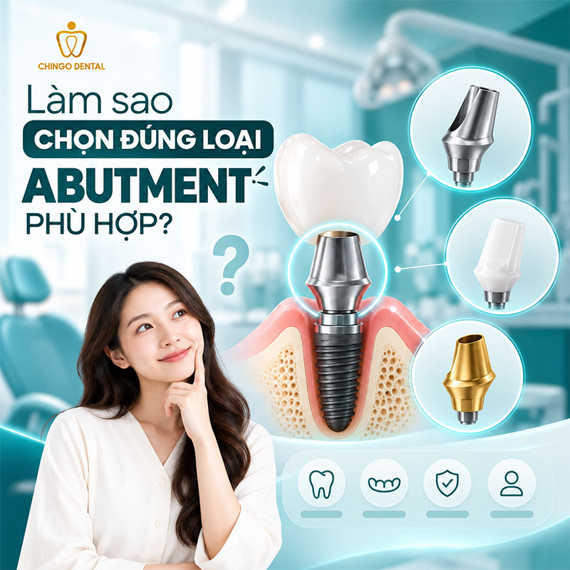 Abutment Là Gì? Tất Cả Những Điều Bạn Cần Biết Về Trụ Kết Nối Implant 6 multi abutment