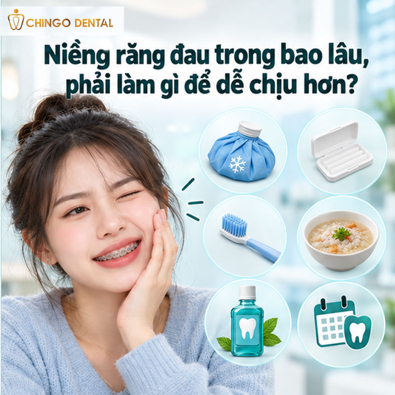 Niềng Răng Nhanh Mất Bao Lâu? Lộ Trình Thực Tế Từ Gắn Mắc Cài Đến Ngày Tháo Niềng 4 niềng răng bao lâu