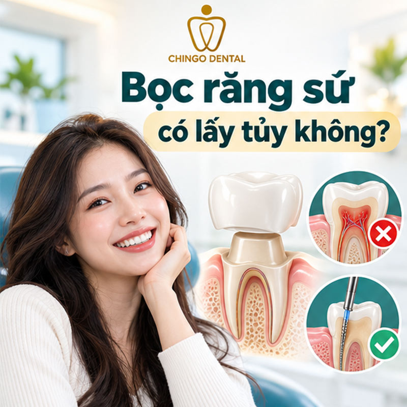 Bọc Răng Sứ Có Lấy Tủy Không? Giải Đáp Chi Tiết - Chingo Dental 1 răng bọc sứ bị viêm tuỷ