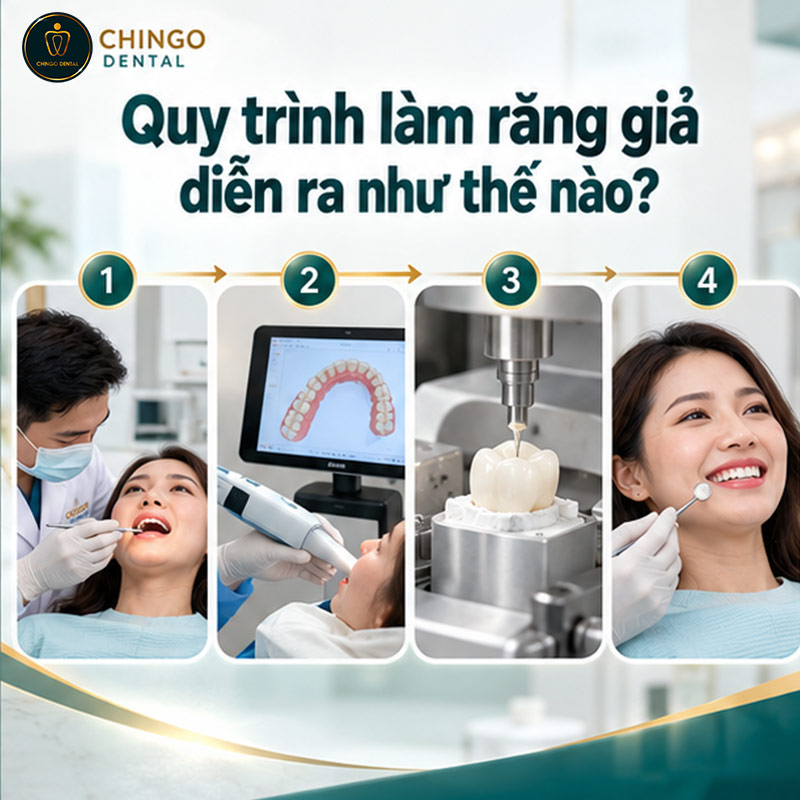 răng giả silicon
