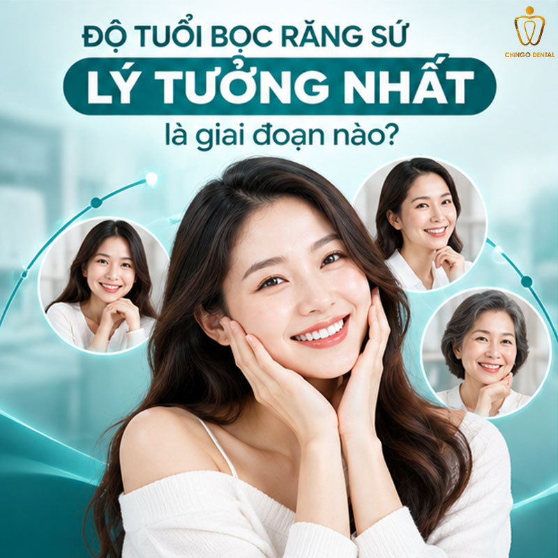 Độ Tuổi Bọc Răng Sứ: Bao Nhiêu Tuổi Là Phù Hợp Và Những Điều Cần Biết 3 răng sứ được bao nhiêu năm