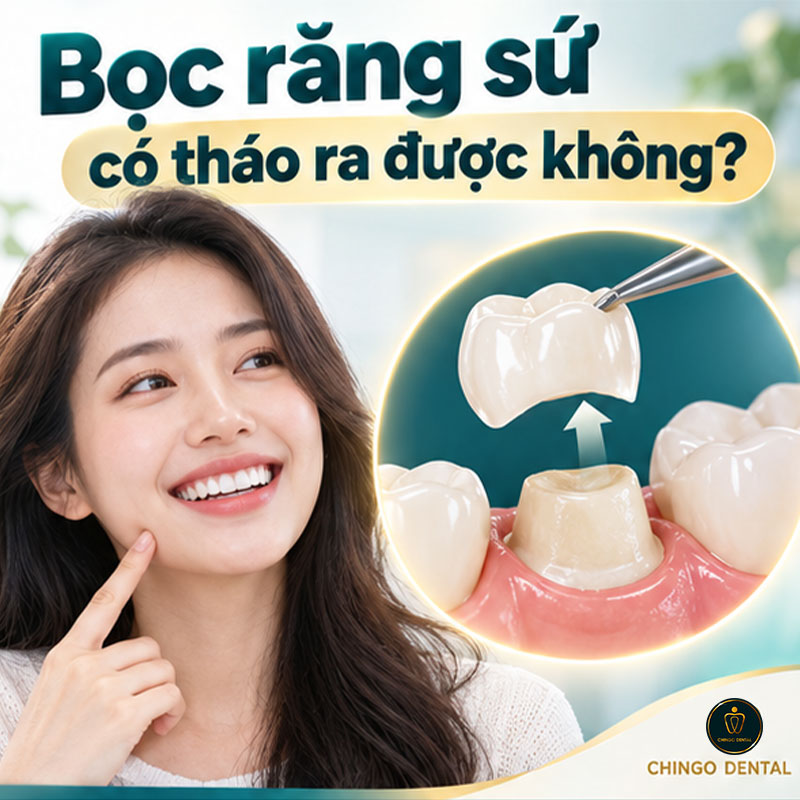Bọc Răng Sứ Có Tháo Ra Được Không? Bác Sĩ Giải Đáp Toàn Diện 1 tháo răng sứ có đau không