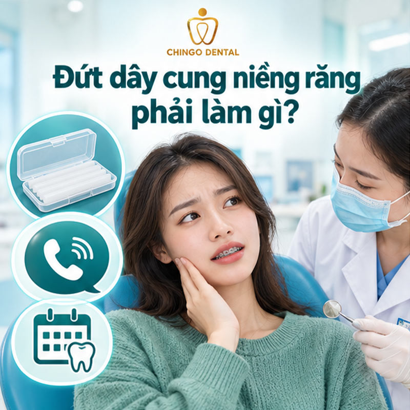 Đứt Dây Cung Niềng Răng: Nguyên Nhân, Cách Xử Lý Tạm Thời & Khi Nào Cần Gặp Bác Sĩ Ngay 3 rơi mắc cài