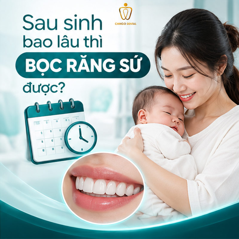 Độ Tuổi Bọc Răng Sứ: Bao Nhiêu Tuổi Là Phù Hợp Và Những Điều Cần Biết 4 sau sinh bao lâu thì bọc răng sứ được