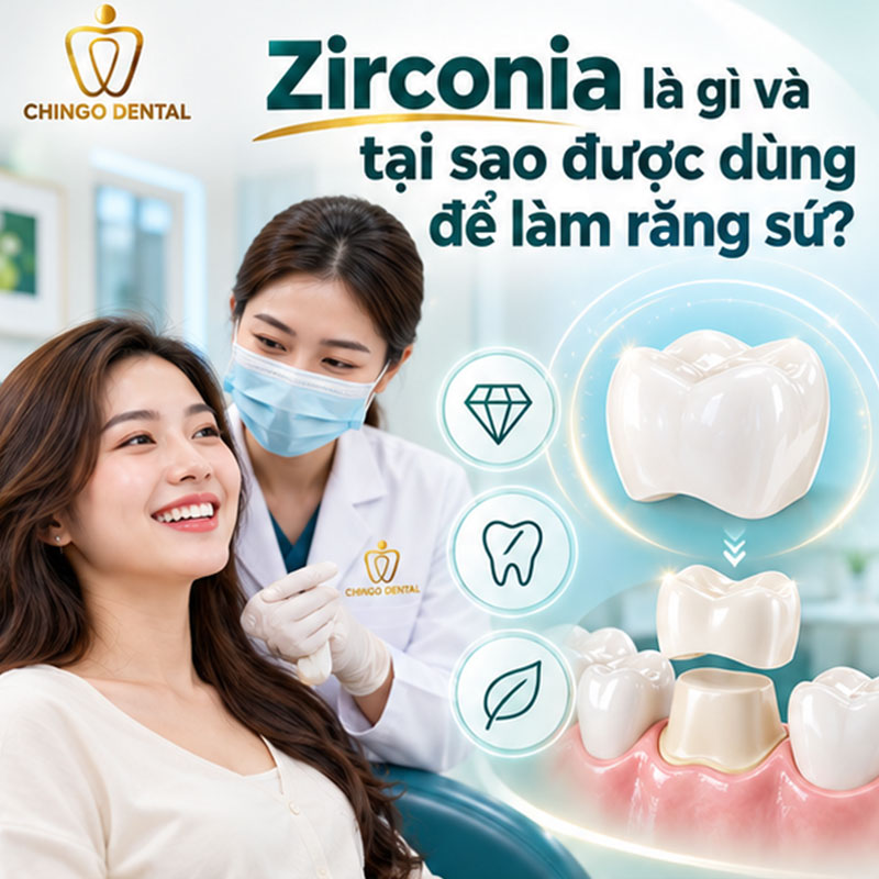 Răng Sứ Zirconia Là Gì? Phân Loại, Ưu Nhược Điểm & Bảng Giá Tham Khảo 1 sứ zirconia