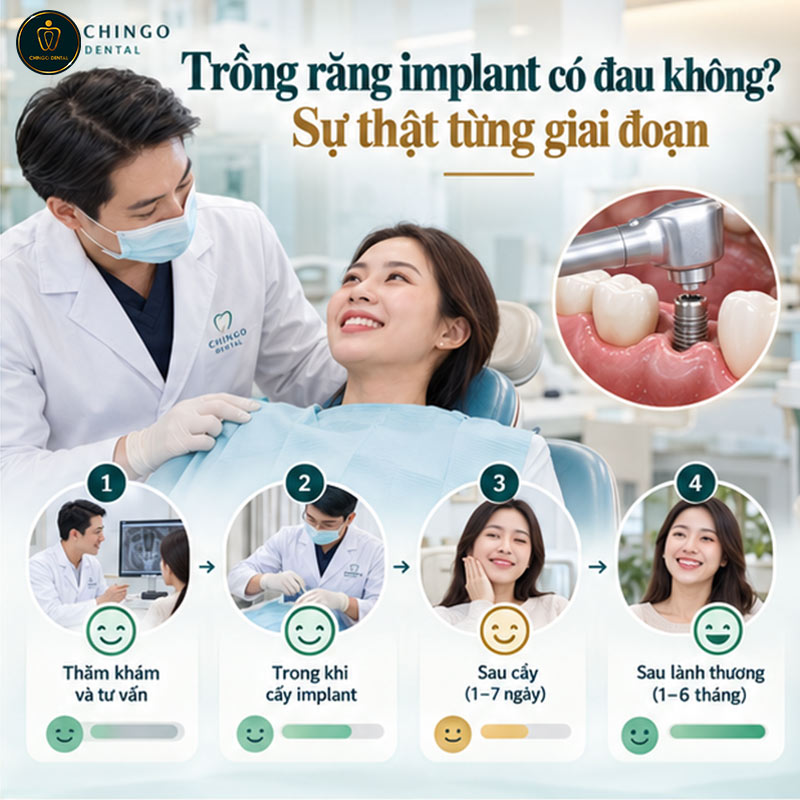 Trồng Răng Implant Có Đau Không? Giải Đáp Toàn Diện Từ A - Z 2 trồng răng có đau không
