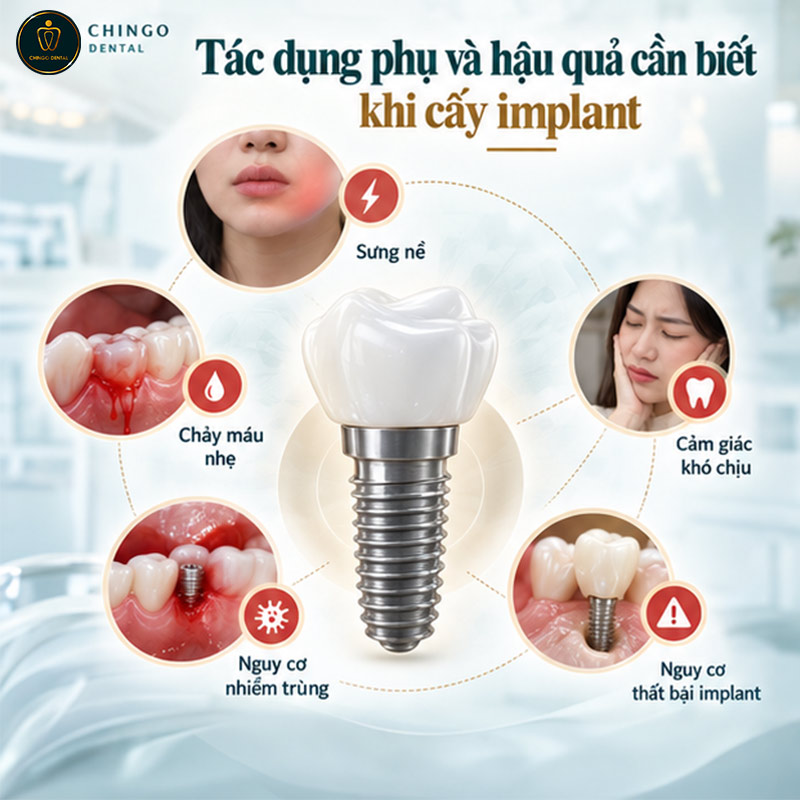Trồng Răng Implant Có Đau Không? Giải Đáp Toàn Diện Từ A - Z 3 trồng răng implant có nguy hiểm không