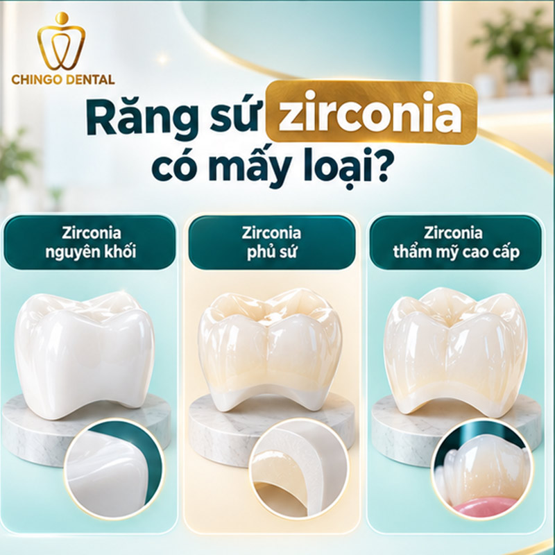 Răng Sứ Zirconia Là Gì? Phân Loại, Ưu Nhược Điểm & Bảng Giá Tham Khảo 2 zirconia là gì